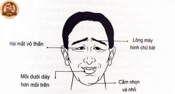 Tướng yểu mệnh qua từng hạn tuổi