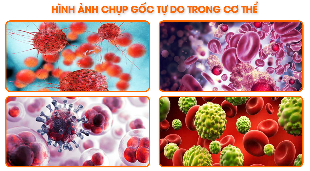 Hình ảnh chụp gốc tự do trong cơ thể