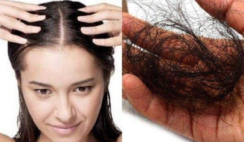 TÓC RỤNG NHIỀU VÀ CÁCH KHẮC PHỤC