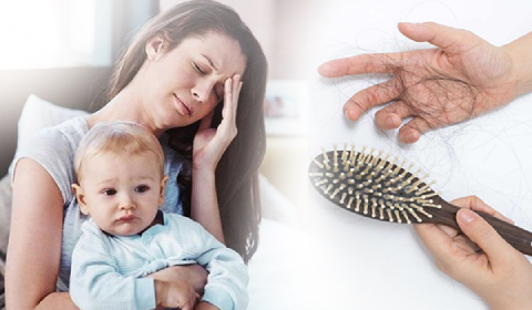 RỤNG TÓC SAU SINH VÀ CÁCH KHẮC PHỤC