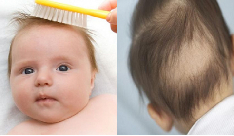 TẠI SAO TÓC TRẺ LẠI RỤNG?