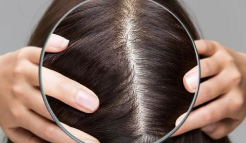 TÓC RỤNG THẾ NÀO LÀ BÌNH THƯỜNG