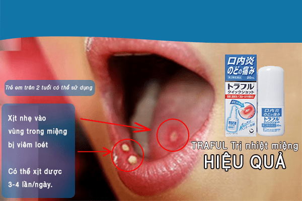 XỊT NHIỆT MIỆNG DAIICHI SANKYO cho trẻ trên 2 tuổi