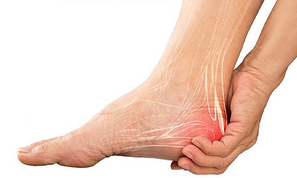 Gai gót chân có nên đi bộ không?