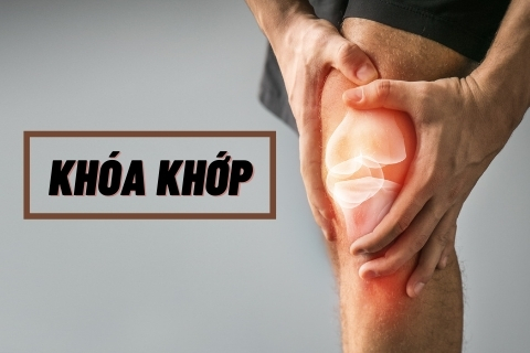 Khóa khớp và những rủi ro nghiêm trọng trong khi tập gym