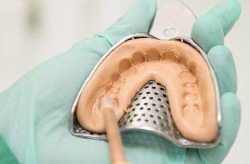 lấy dấu răng có đau không