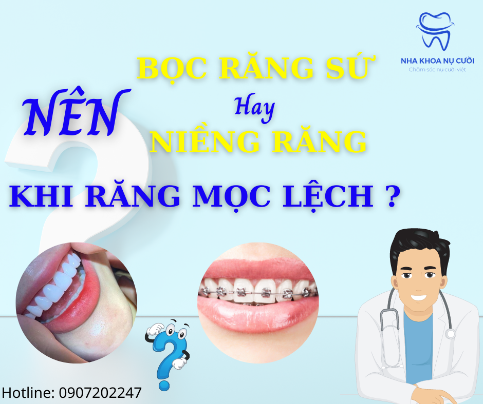 NÊN BỌC RĂNG SỨ HAY CHỈNH NHA KHI RĂNG MỌC LỆCH?