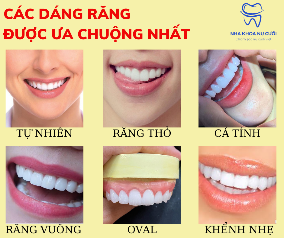 NHA KHOA DUY HƯNG   Chọn hình dáng  màu sắc răng sứ sao cho phù hợp  nhất với bạn  Theo màu da lứa tuổi Với mỗi kiểu màu răng