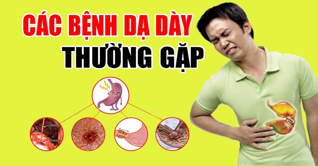 Tổng Hợp Các Bệnh Thường Gặp Ở Dạ Dày Bạn Cần Biết