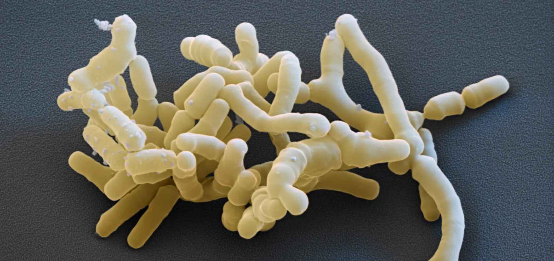 Câu hỏi thường gặp về lợi khuẩn Bifidobacterium