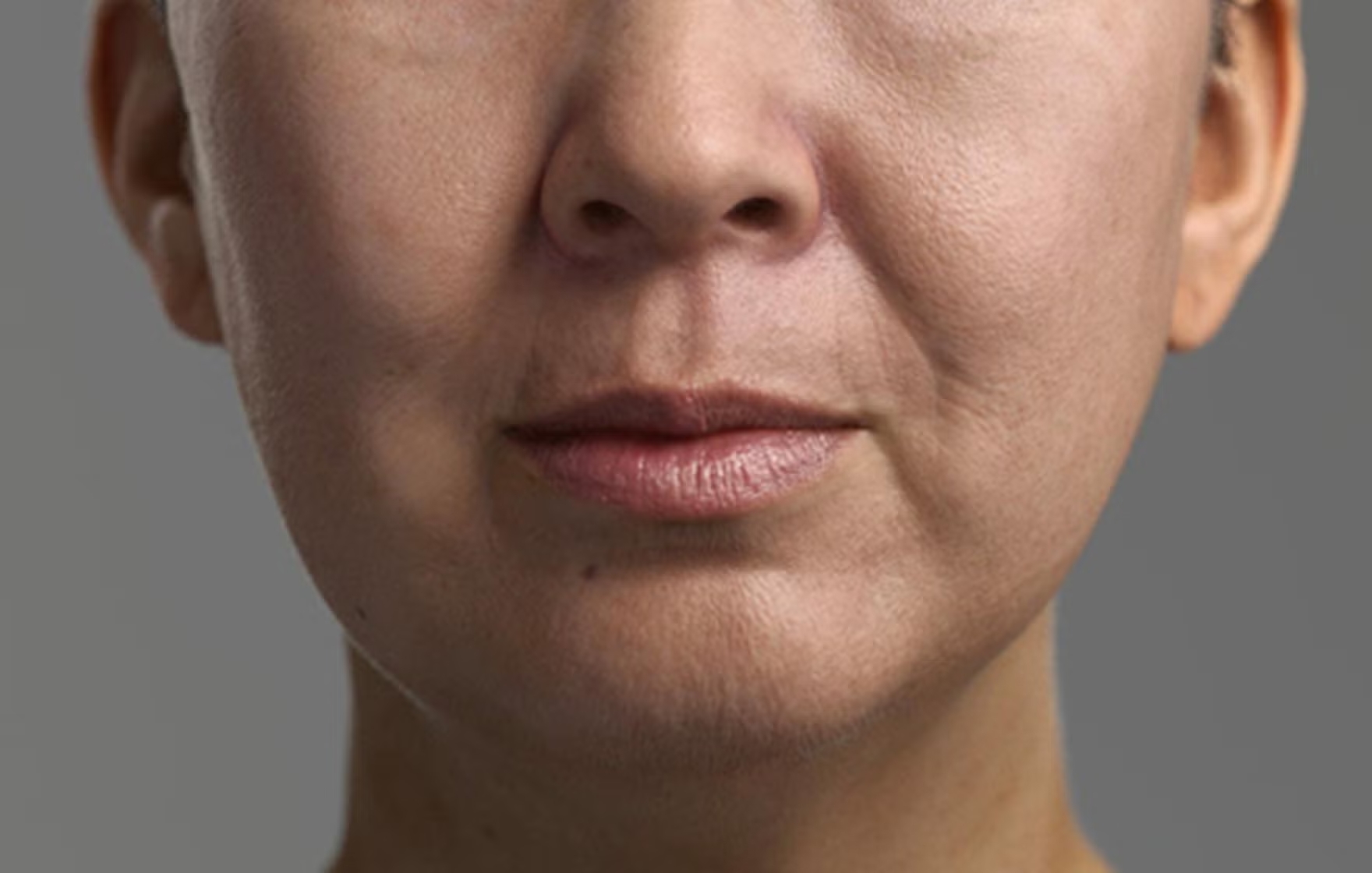 Collagen tự nhiên hao hụt theo tuổi tác