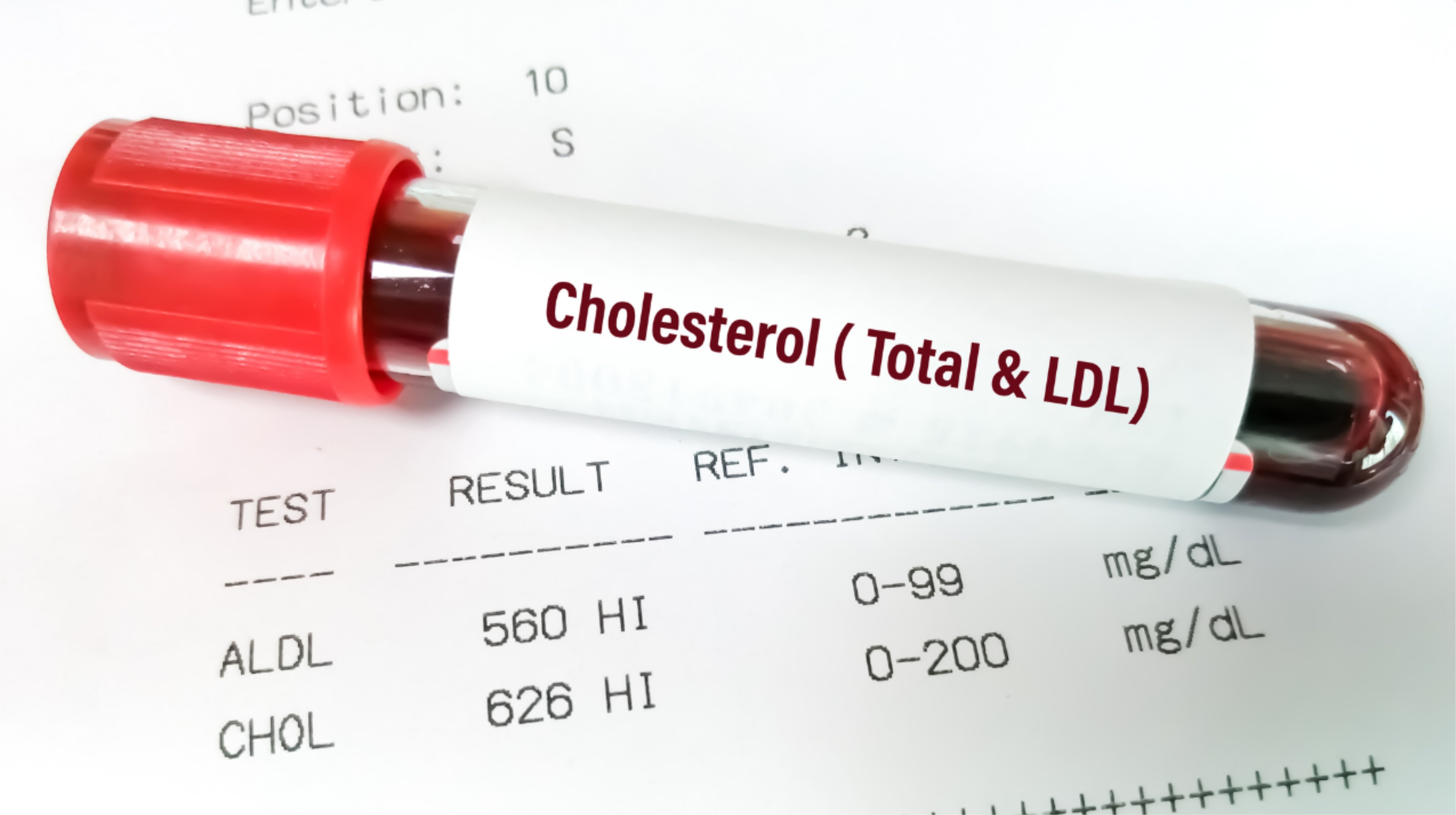 Nghệ Nano giúp duy trì cholesterol ổn định
