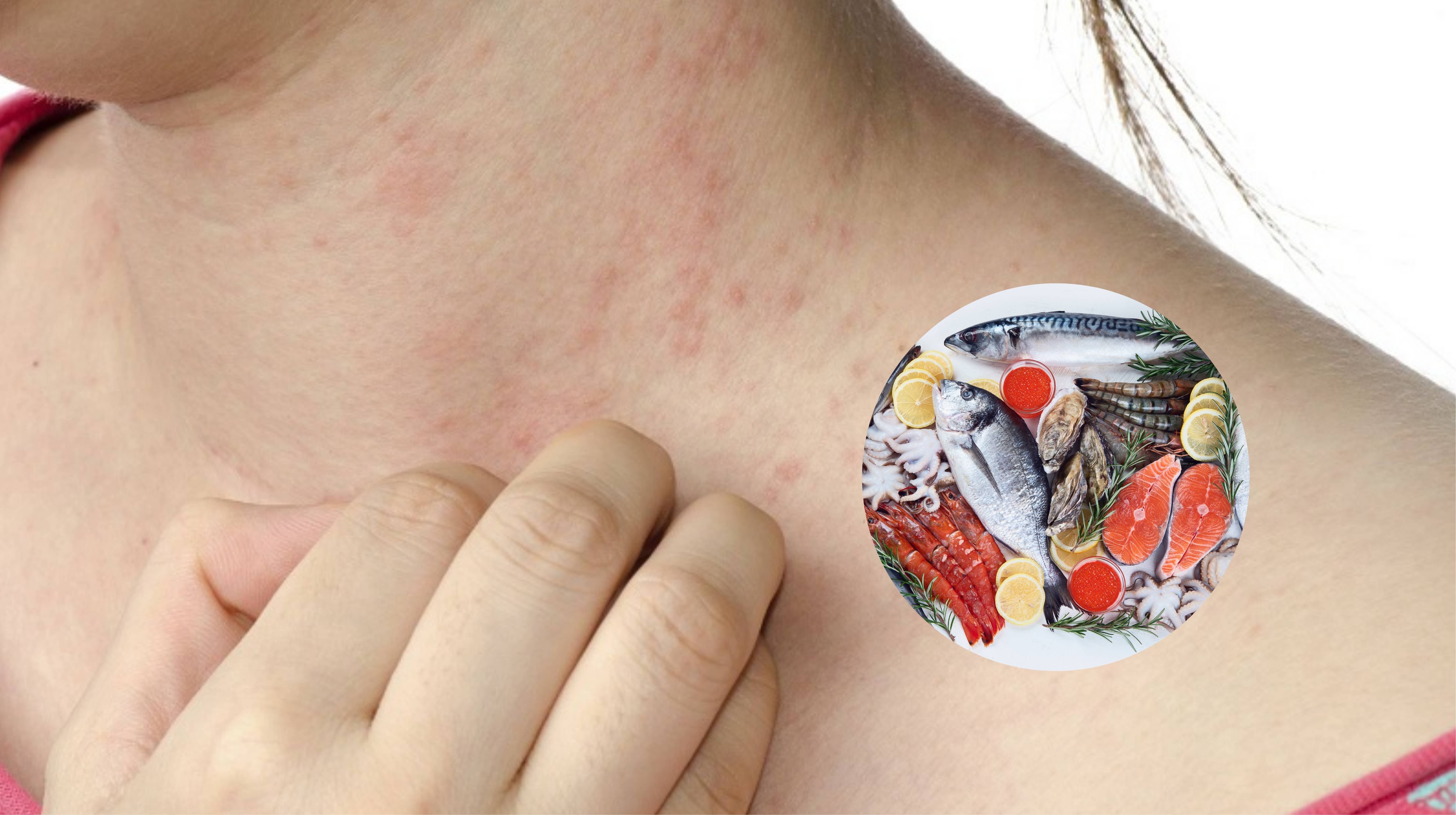 Người dị ứng với hải sản không nên uống Fucoidan Nano