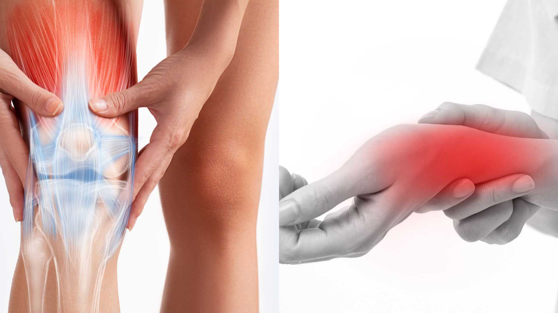 Tỏi đen giúp giảm đau nhức và viêm khớp