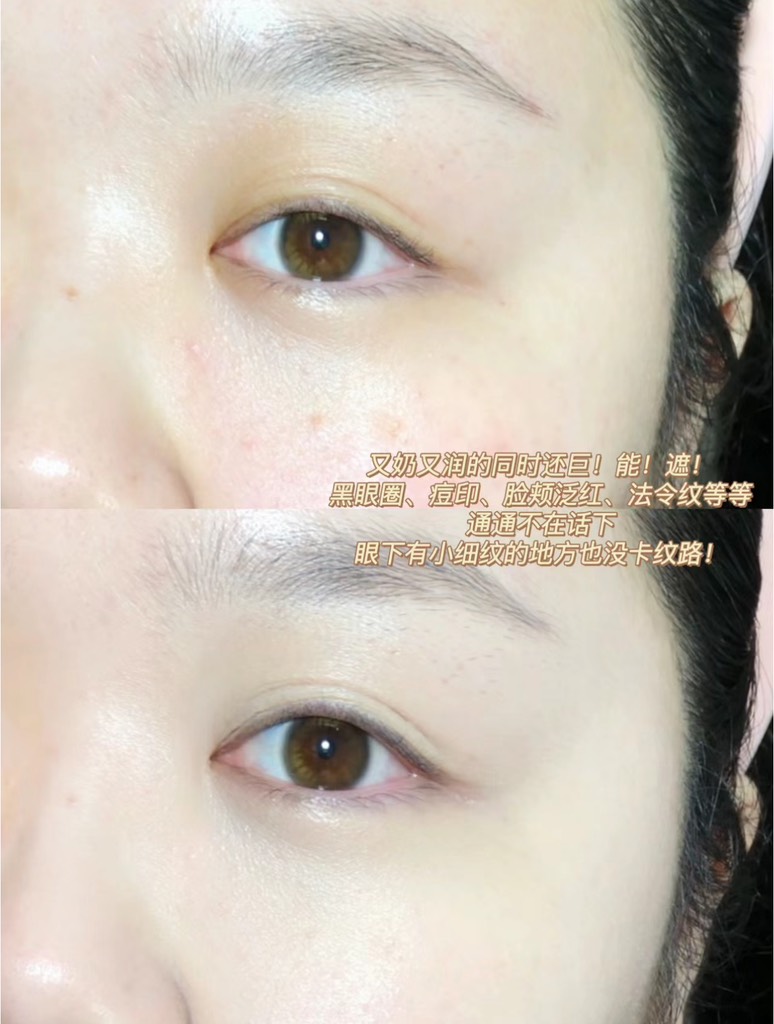 Set 2 Tuýp Che Khuyết Điểm ZFC 2 Colours Eye Circle Cover Liquid 10g