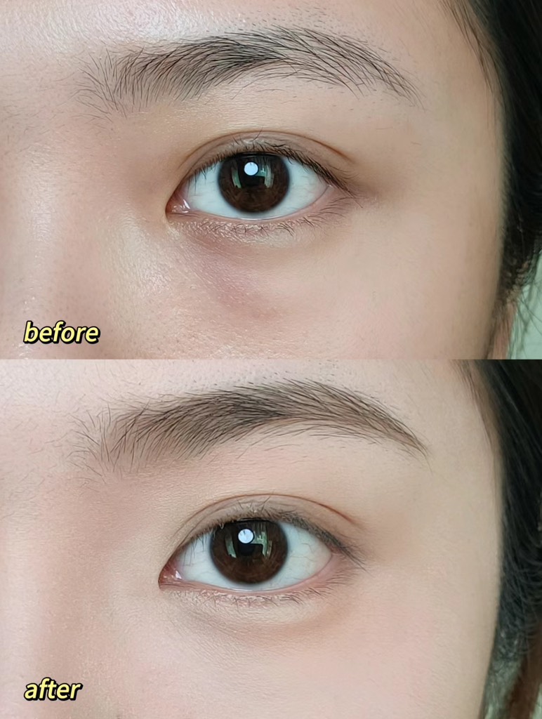 Set 2 Tuýp Che Khuyết Điểm ZFC 2 Colours Eye Circle Cover Liquid 10g