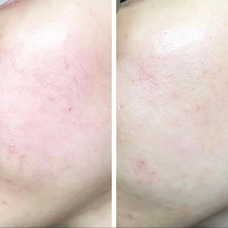 Serum Keo Ong CNP Propolis Energy Active Ampule