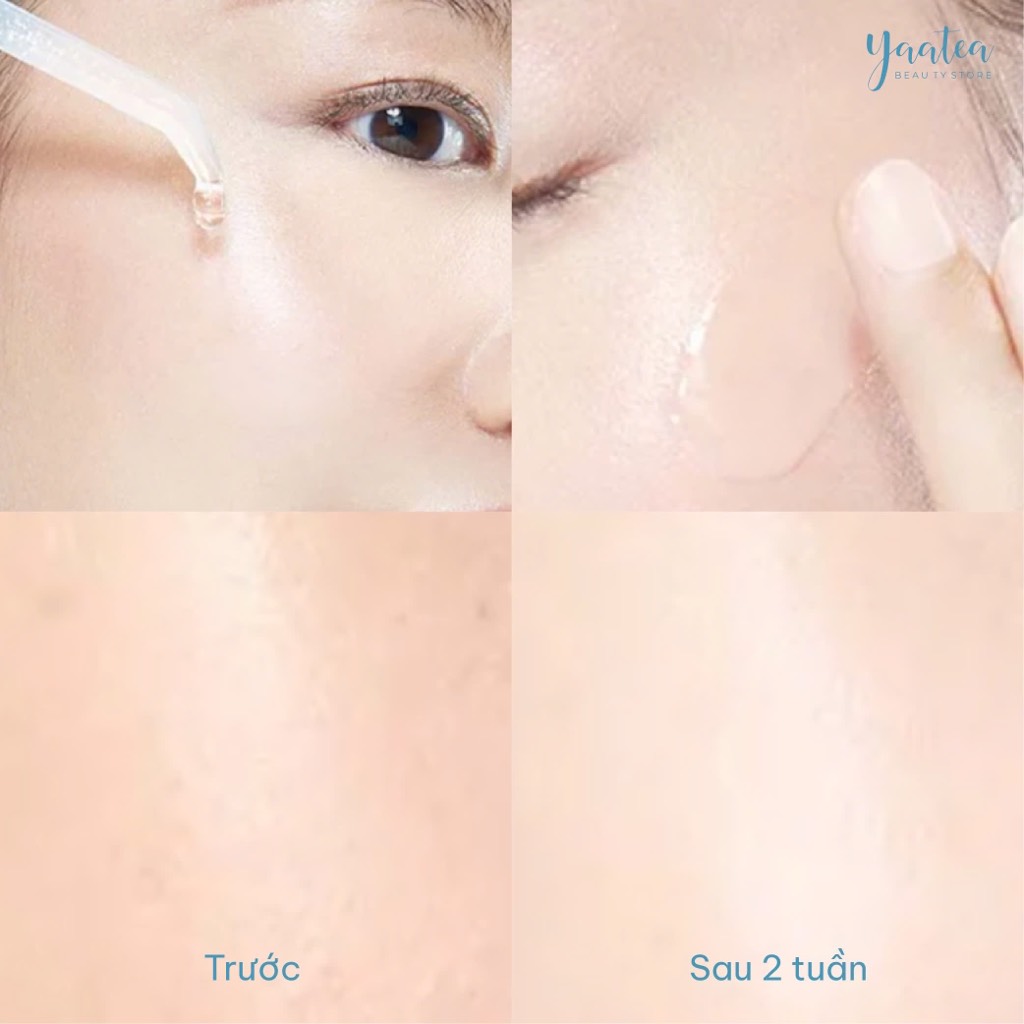 Serum Cấp ẩm Senka Deep Moist 3X HA 30ml