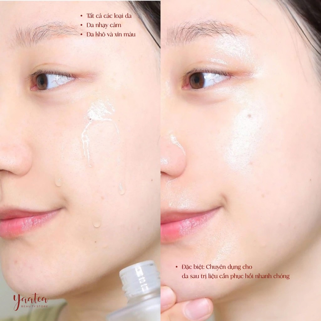 Nước Thần CNP Propolis Treatment Ampule Essence