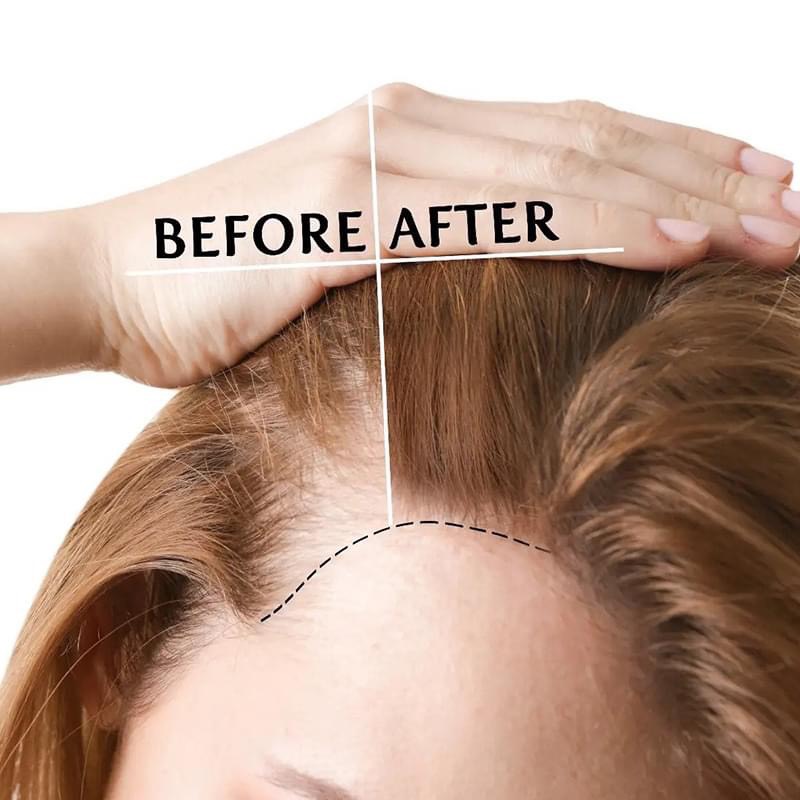 Bộ sản phẩm Kích Mọc tóc Mielle Rosemary Mint Strengthening