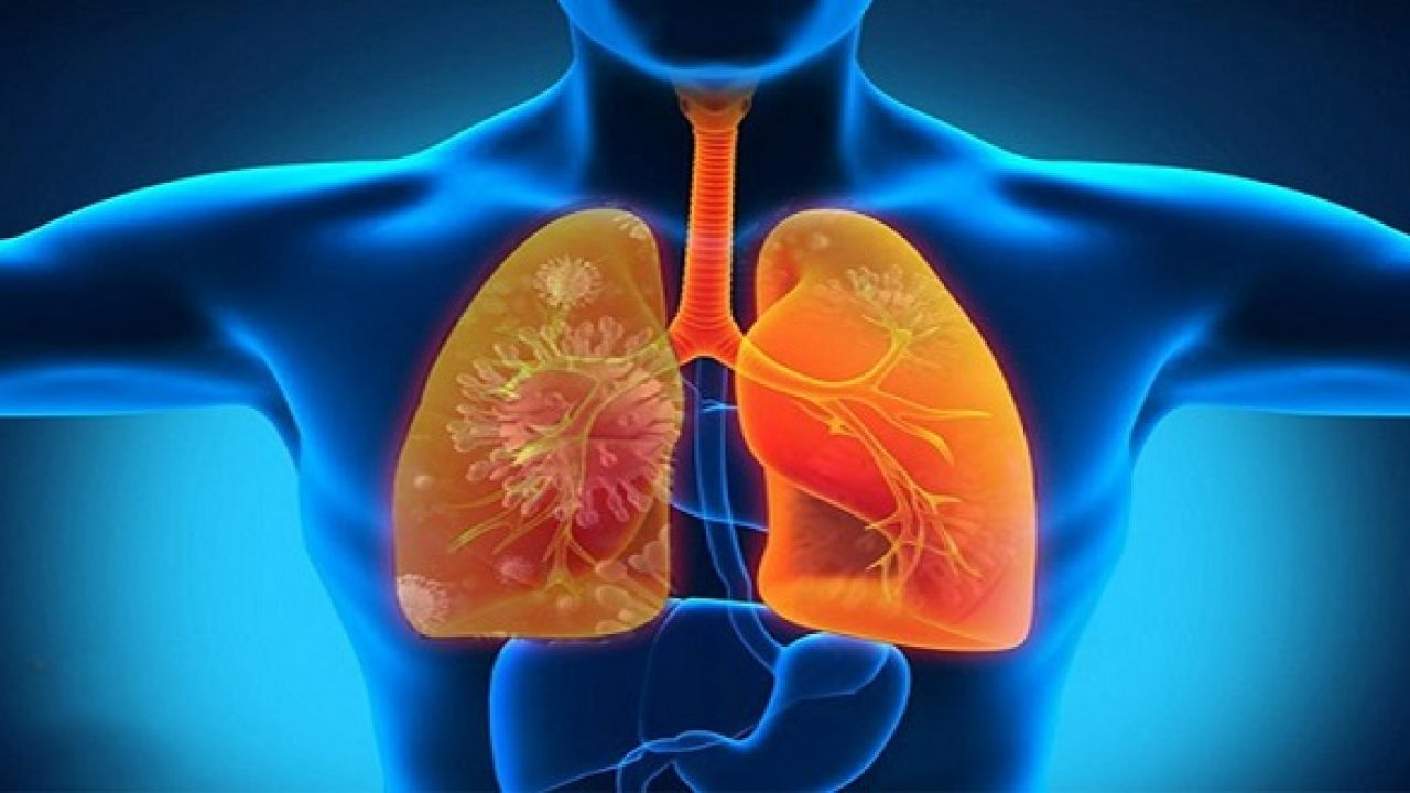 CÁCH THẢI ĐỘC CHO PHỔI