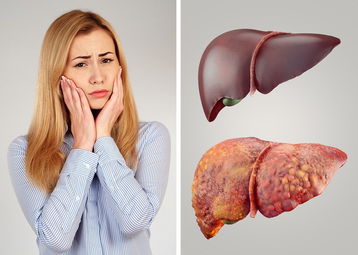 CƠ THỂ TÍCH LŨY ĐỘC TỐ