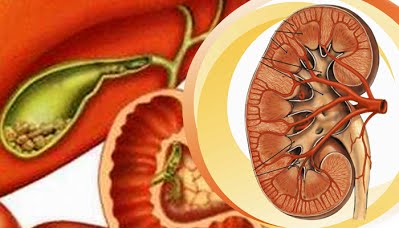 BỆNH SỎI MẬT VÀ CÁC PHƯƠNG PHÁP ĐIỀU TRỊ THEO TÂY Y