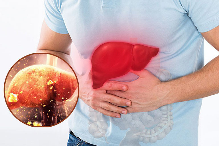 MEN GAN TĂNG CAO GÂY NGUY HIỂM GÌ?