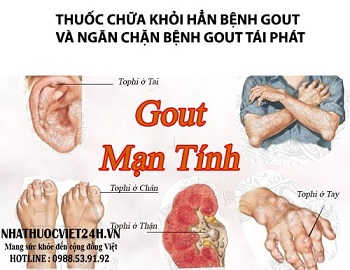 thuoc-chua-khoi-han-benh-gout-va-ngan-chan-benh-gout-tai-phat