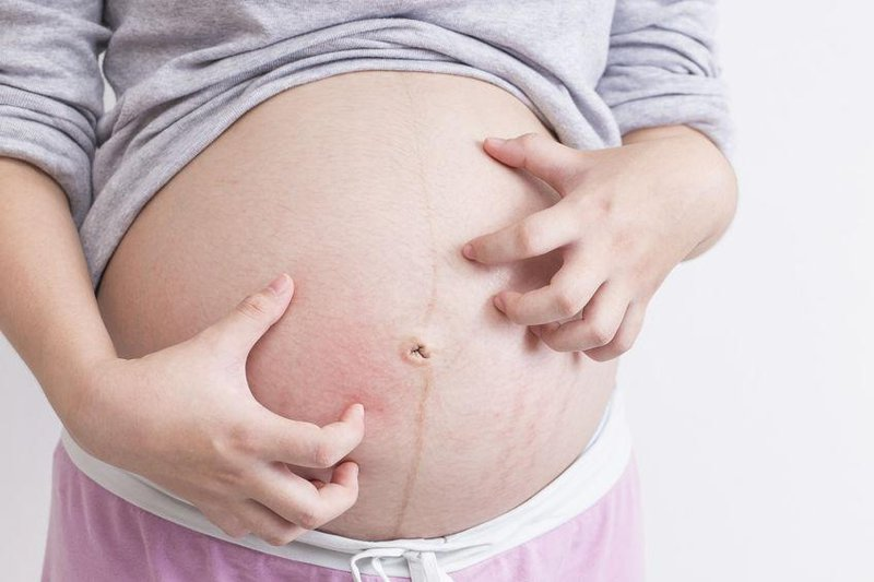 Bà bầu thường có cảm giác ngứa ngáy, khó chịu ngoài da
