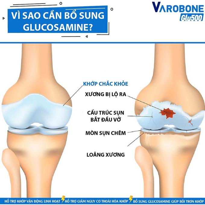 Shinpoong Varobone Glu 500 giúp khớp linh hoạt, Chai 60 viên