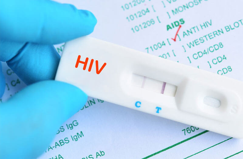 Thời điểm nào xét nghiệm HIV là chính xác nhất ?