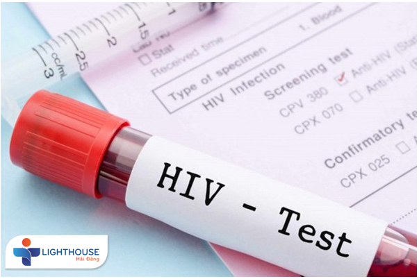 Tại sao cần xét nghiệm HIV? Những phương pháp xét nghiệm HIV phổ biến hiện nay