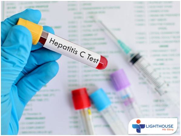 Xét nghiệm Viêm gan C – chìa khóa phát hiện và đẩy lùi VGC