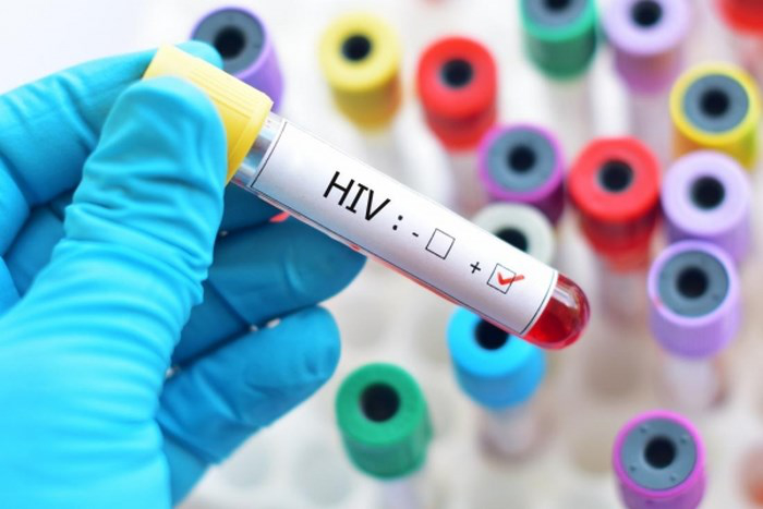 Tổng hợp các phương pháp xét nghiệm HIV