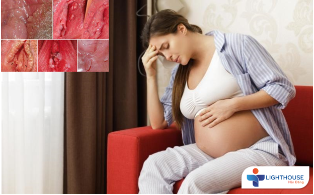 Bệnh sùi mào gà nguy hiểm khôn lường?