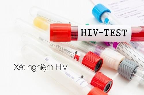 Tổng hợp các phương pháp xét nghiệm HIV