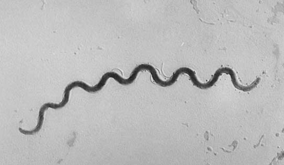 xoan khuan giang mai