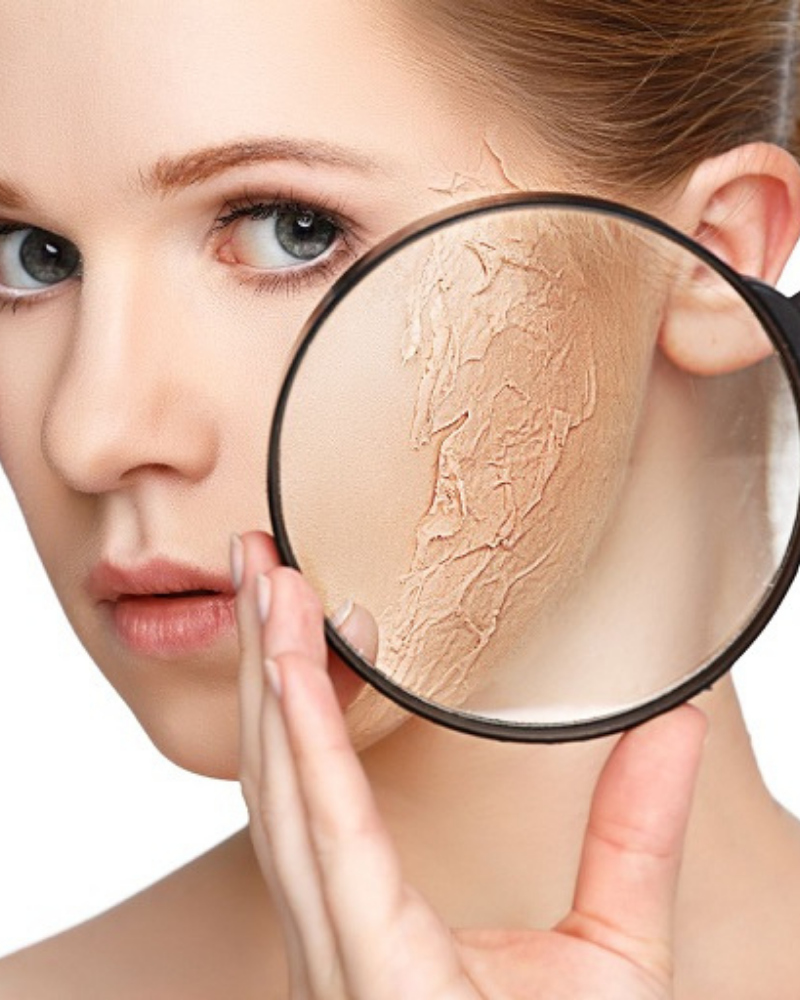 Da mất nước và cách khắc phục