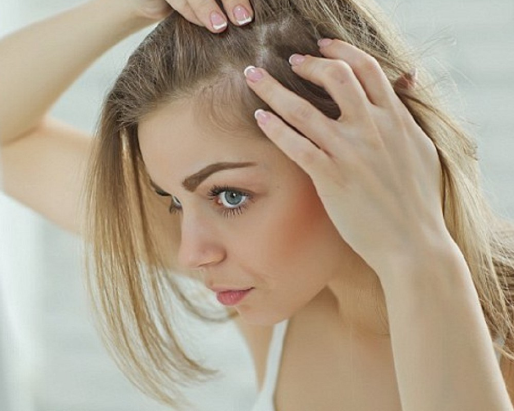 Da đầu thường rát đỏ, vảy bã - nguyên nhân vì sao, cách nào hiệu quả?