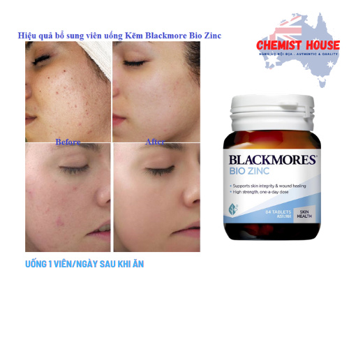 Viên uống bổ sung kẽm khỏe da - Blackmores Bio Zinc Hàng chuẩn nội địa Úc hàm lượng kẽm 125mg trở lên Date xa