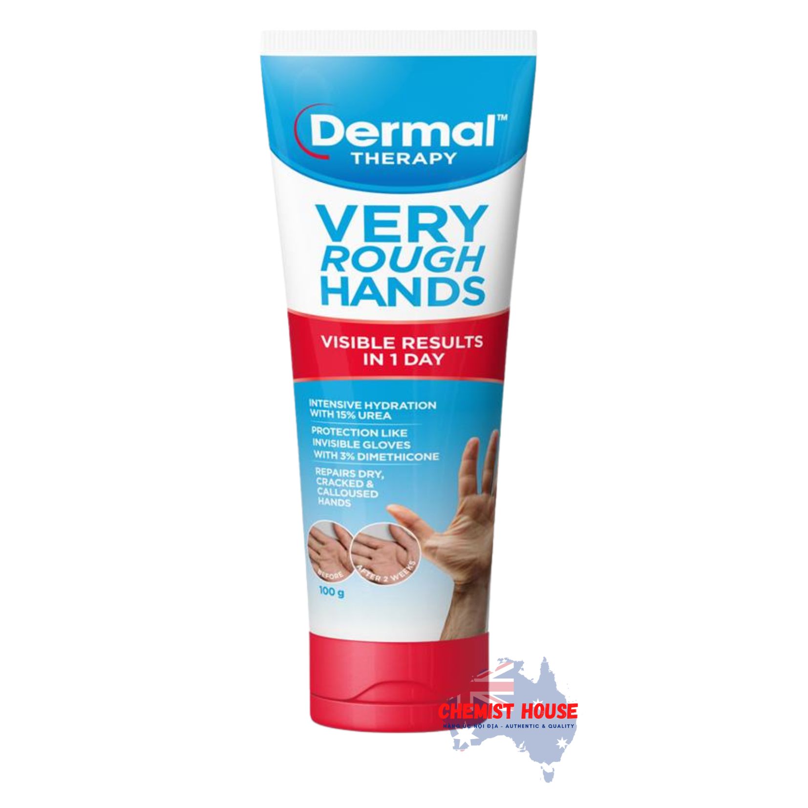 Kem Dưỡng Da Tay Dermal Therapy Very Rough Hand Balm 100g - Dermal Therapy Very Rough Hand Balm 100g