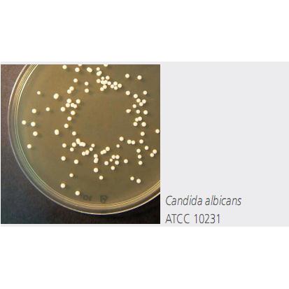 Sabouraud dextrose agar