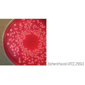 Violet red bile dextrose agar