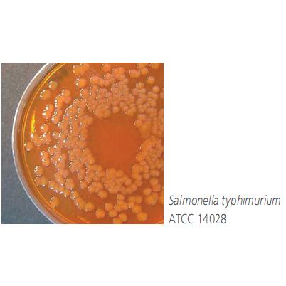 Deoxycholate lactose agar