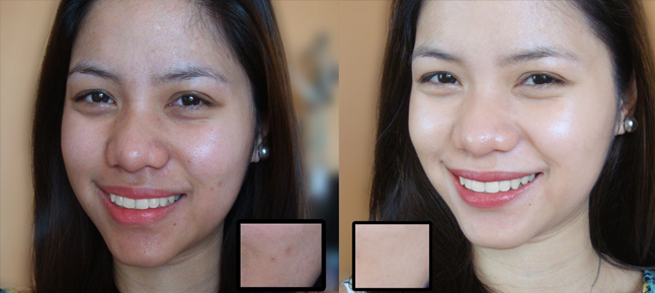 Viên uống trắng da chống lão hóa Sakura L-Glutathione Reduced
