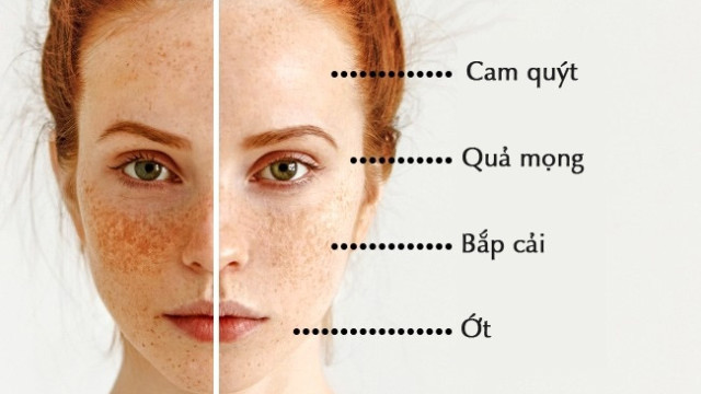 6 bí quyết chọn thực phẩm tốt cho da của một bác sĩ da liễu 6 bí quyết chọn thực phẩm tốt cho da của một bác sĩ da liễu