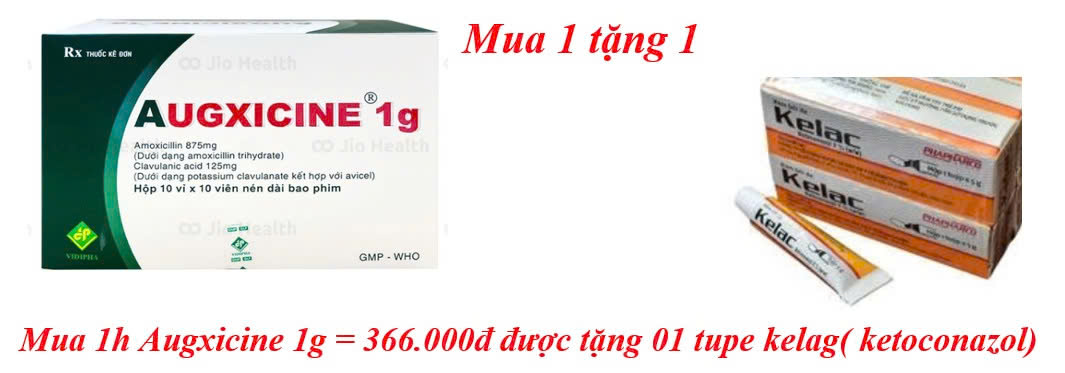 mua-1h-augxicine-1g-366-000d-duoc-tang-01-tupe-kelag-ketoconazol