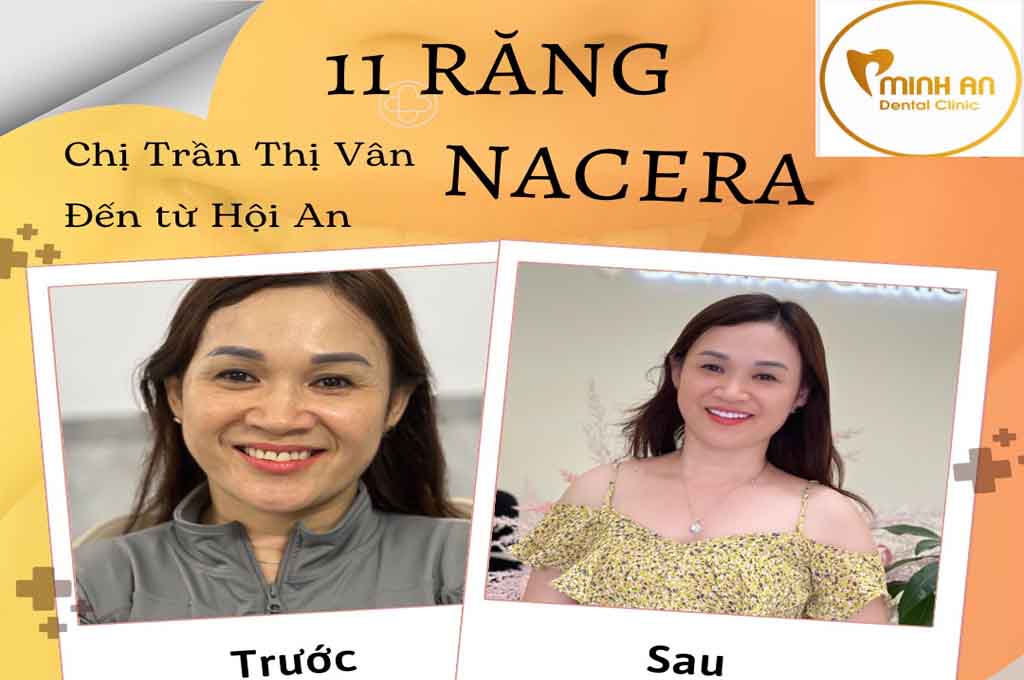 Nha Khoa Đà Nẵng