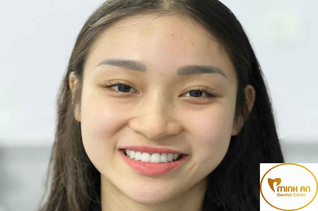 Nha khoa làm răng đẹp Đà Nẵng